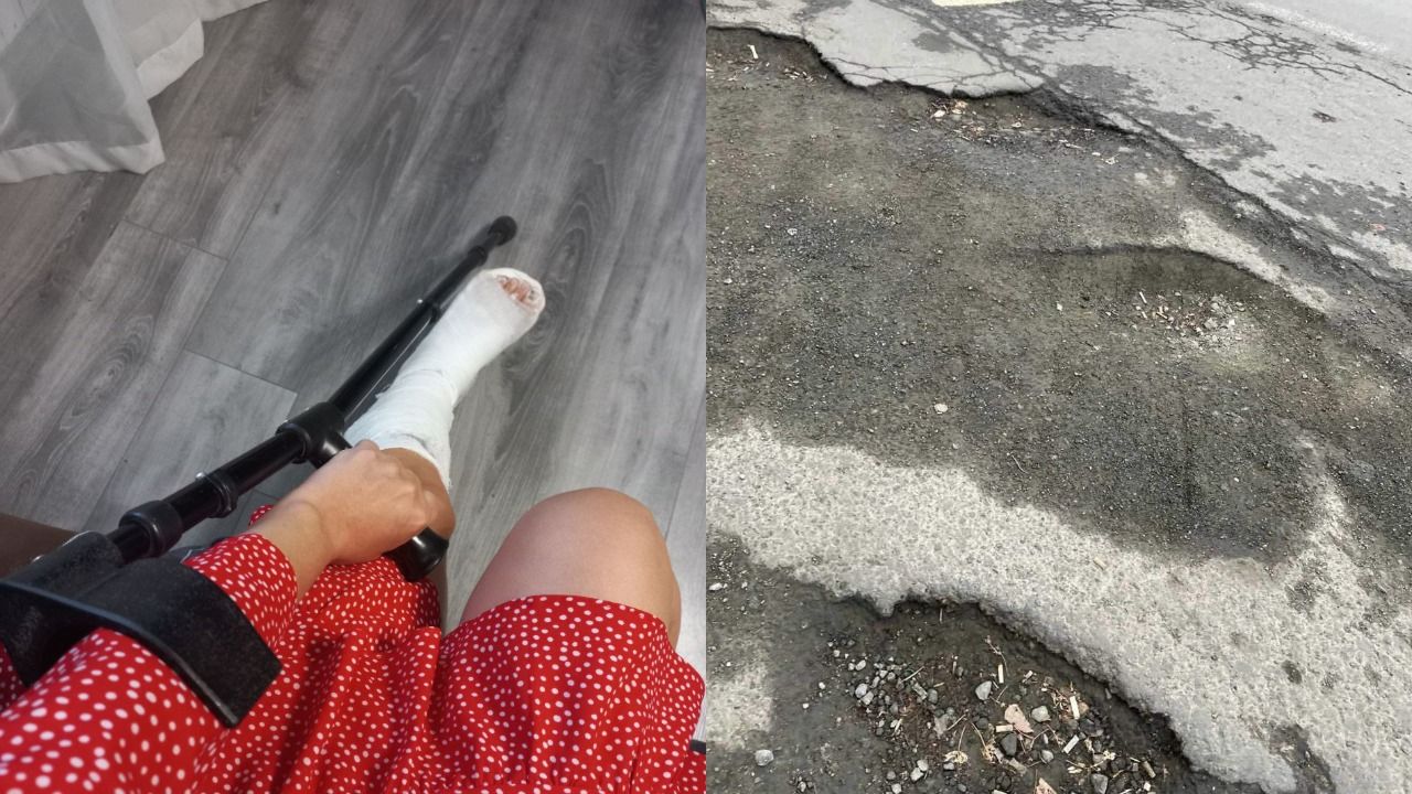 Девушка подвернула ногу. Сломала ногу в Красноярске.